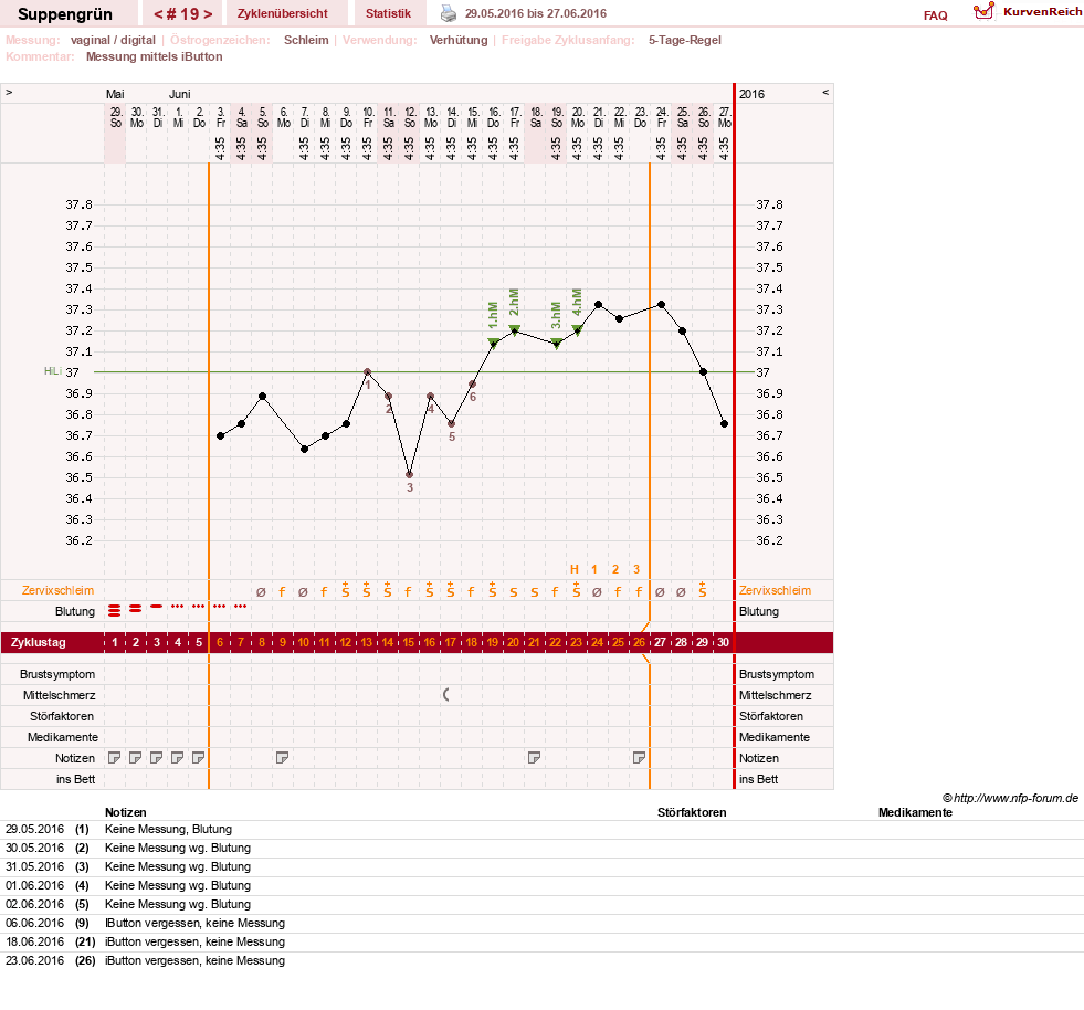 NFP-Kurve User #27255