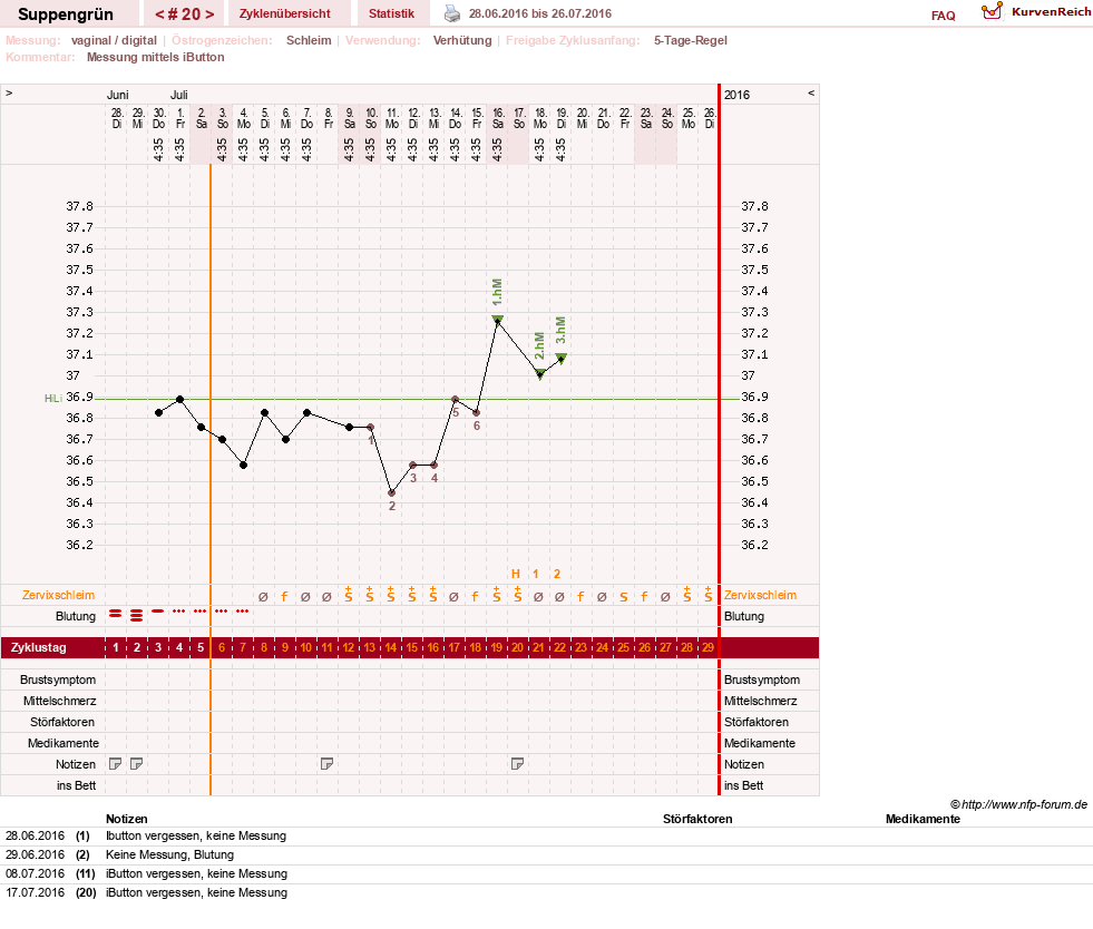 NFP-Kurve User #27255