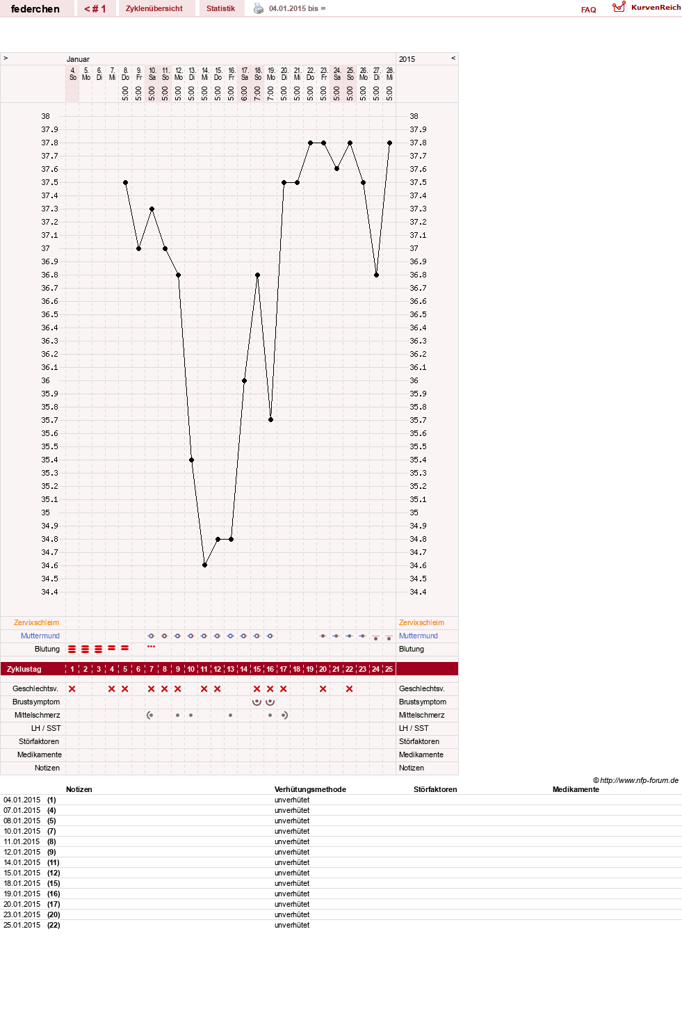 NFP-Kurve User #27400