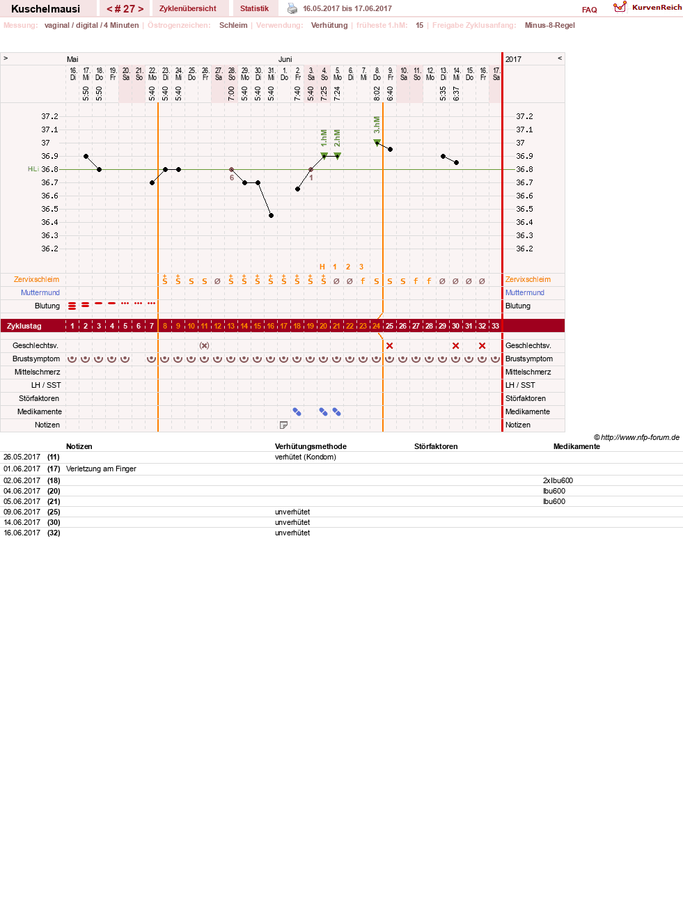 NFP-Kurve User #27444
