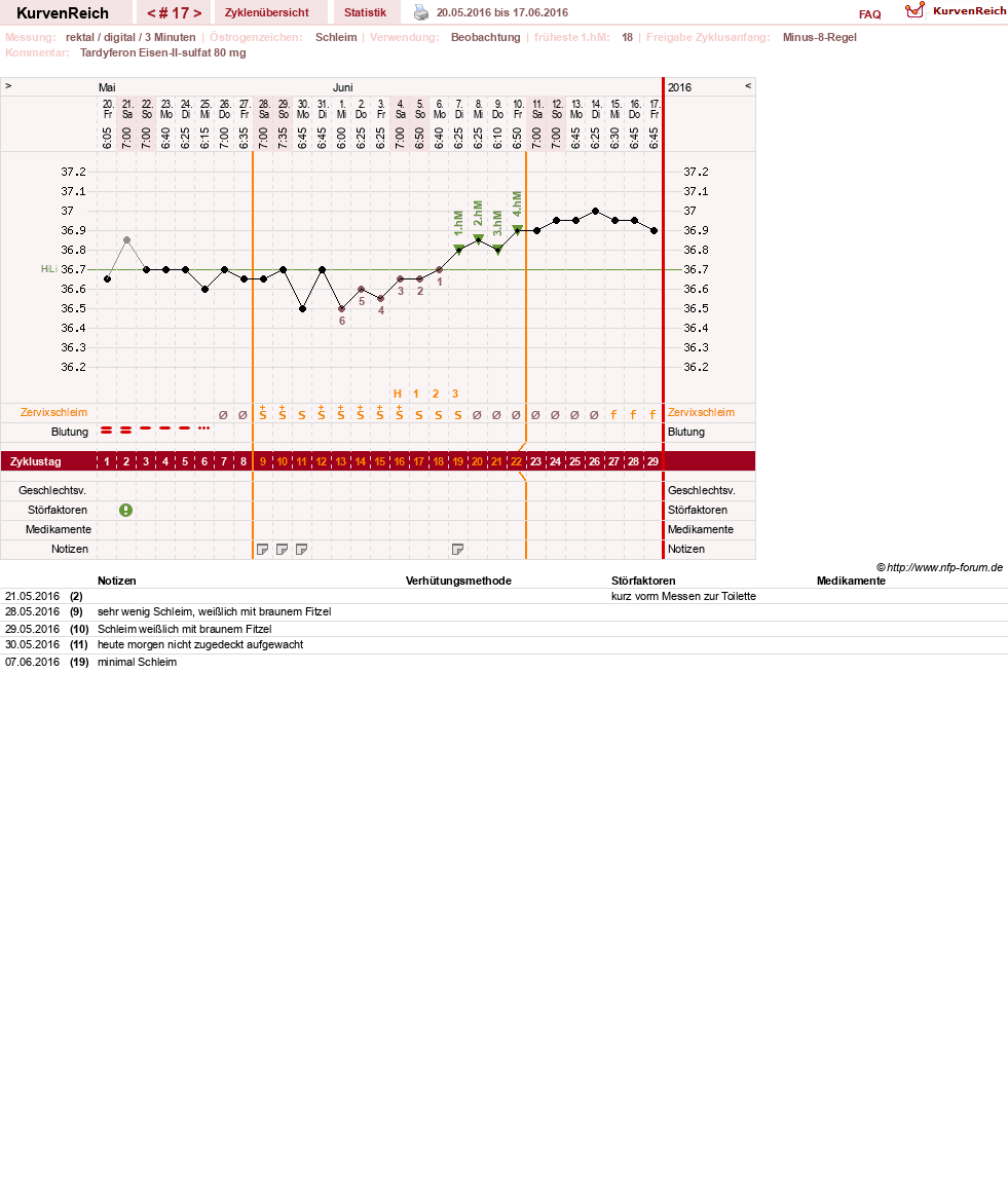 NFP-Kurve User #27487