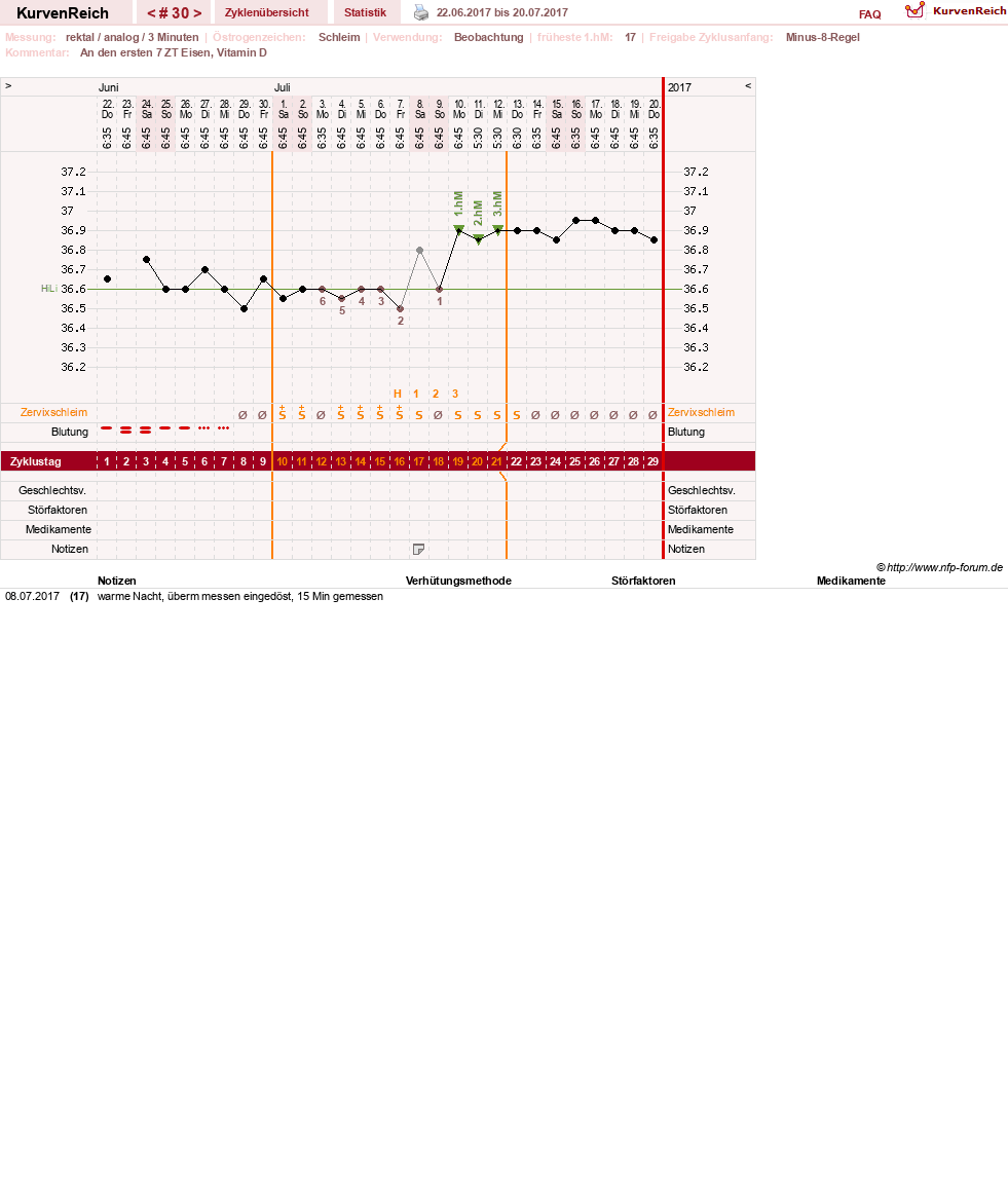NFP-Kurve User #27487