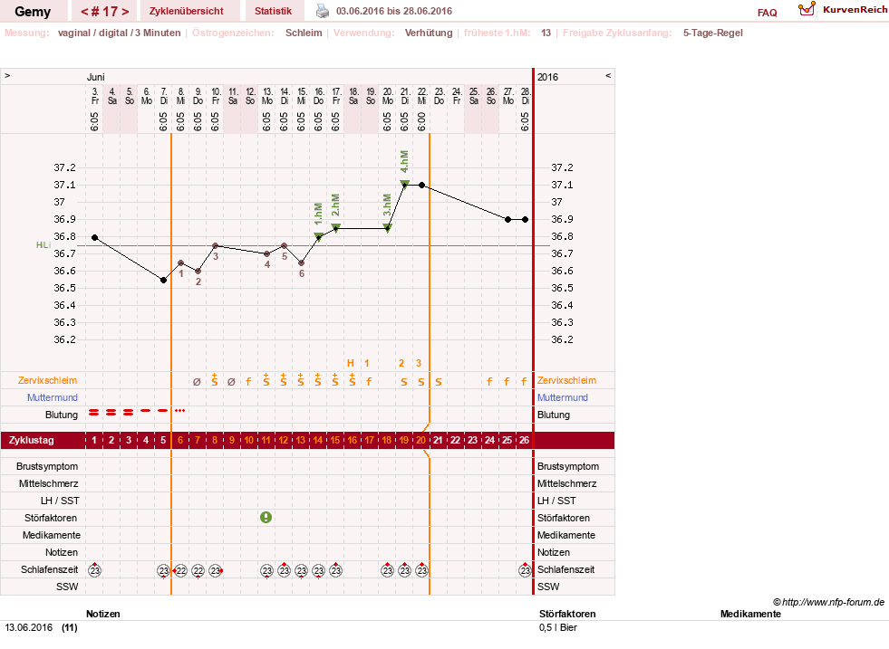 NFP-Kurve User #27520