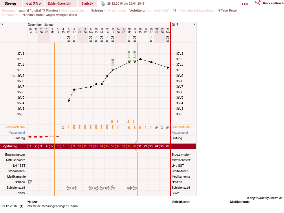 NFP-Kurve User #27520