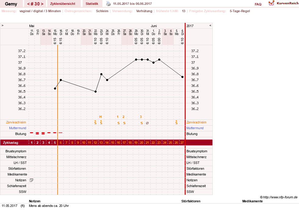 NFP-Kurve User #27520