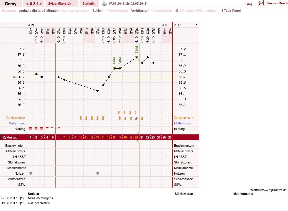 NFP-Kurve User #27520