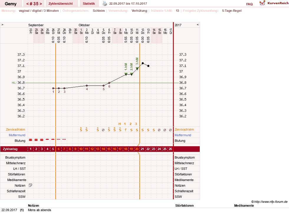NFP-Kurve User #27520