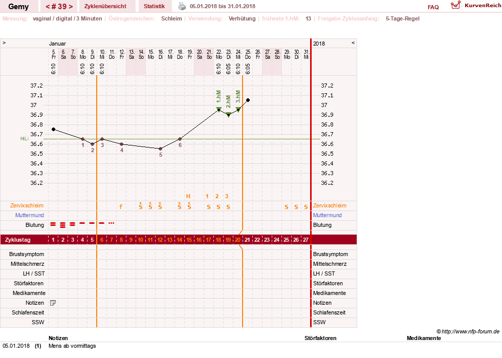 NFP-Kurve User #27520