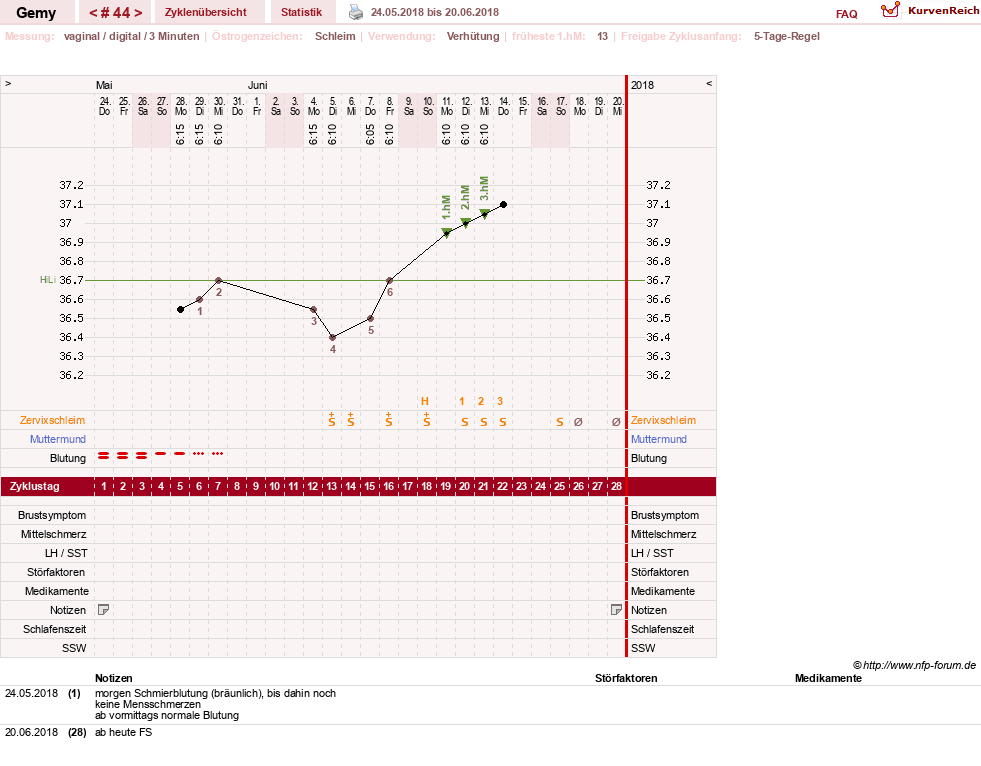 NFP-Kurve User #27520