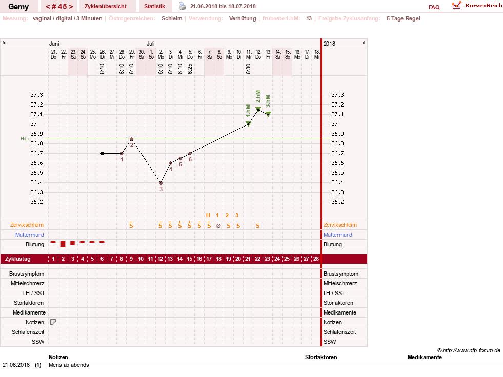 NFP-Kurve User #27520