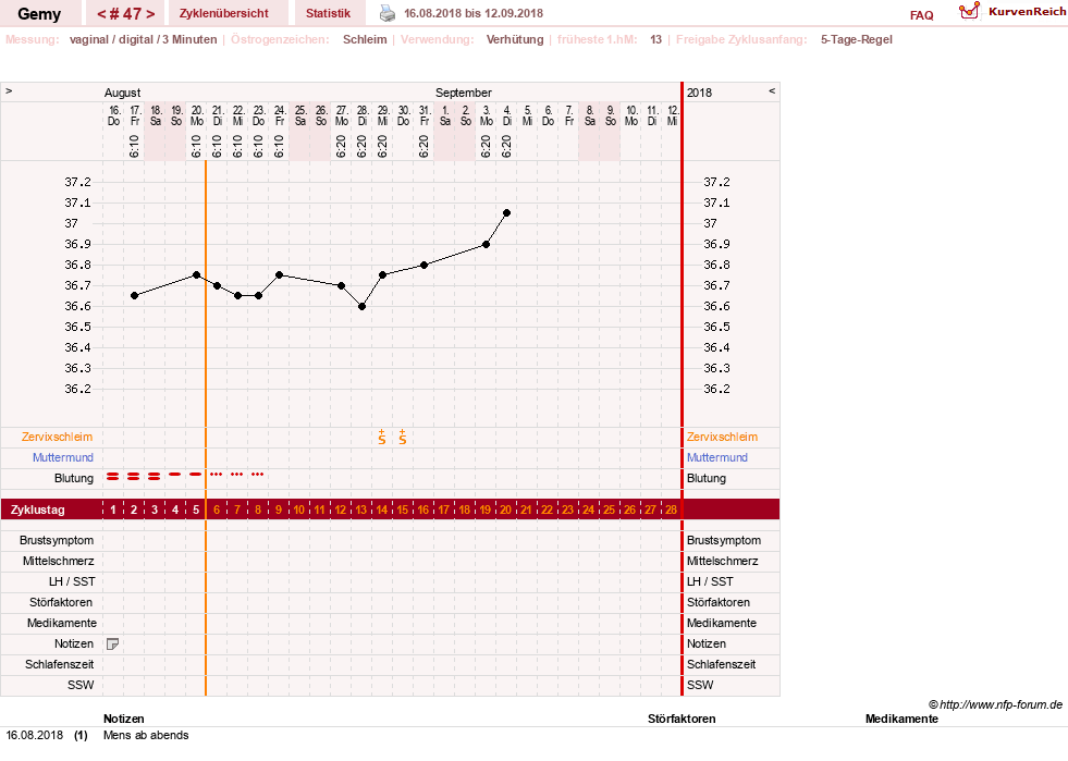 NFP-Kurve User #27520