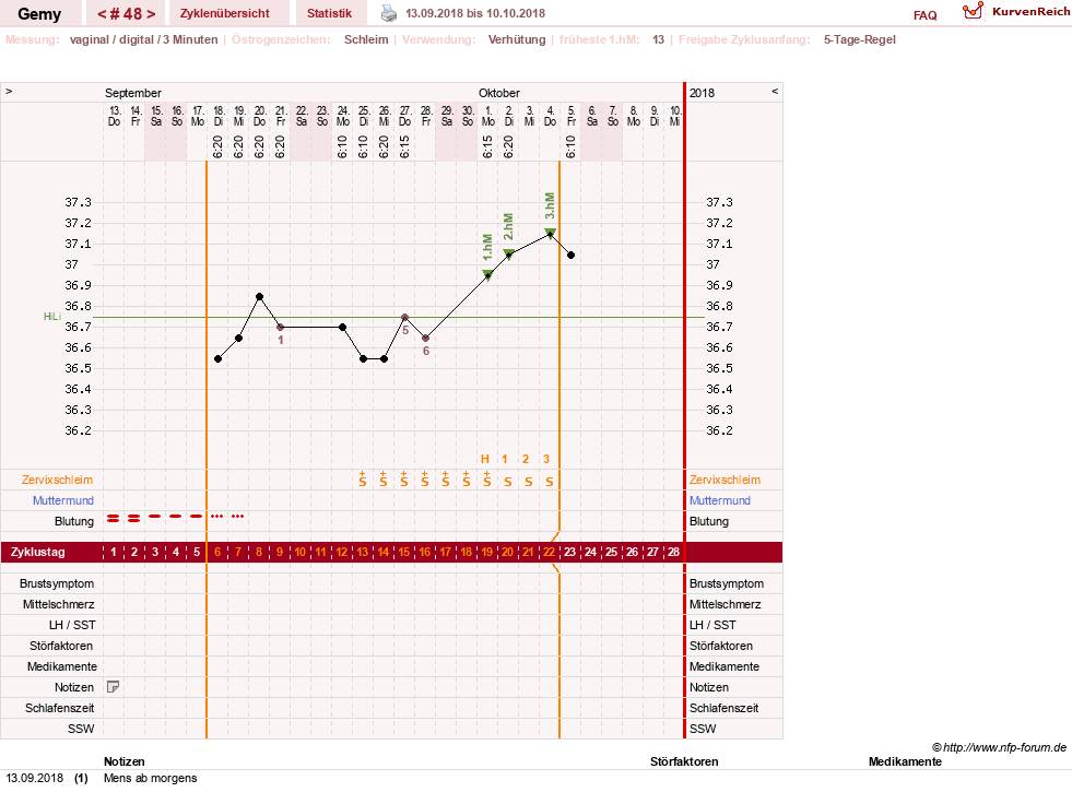 NFP-Kurve User #27520