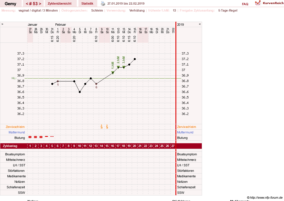 NFP-Kurve User #27520