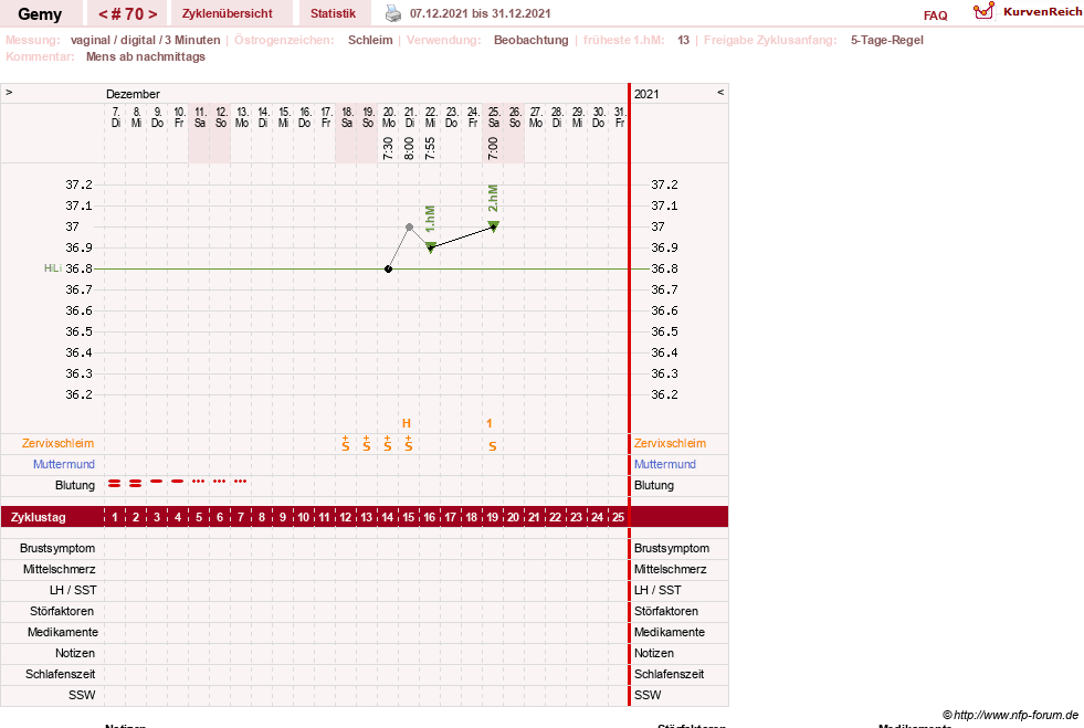 NFP-Kurve User #27520