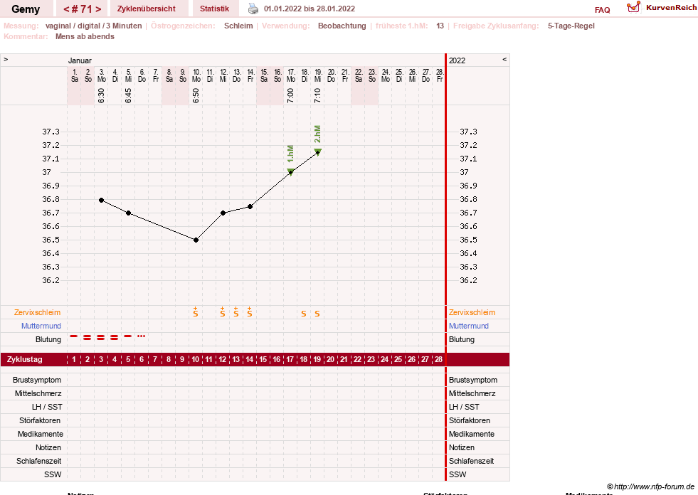 NFP-Kurve User #27520