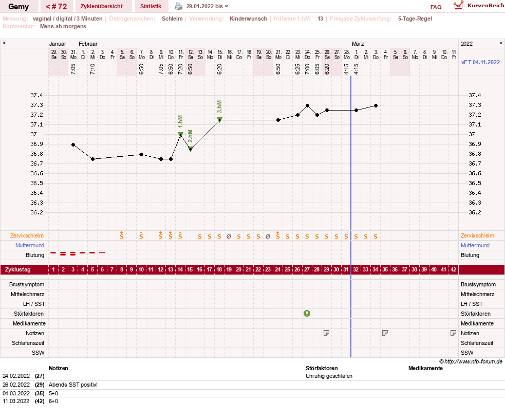 NFP-Kurve User #27520
