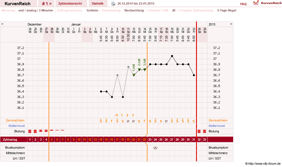 NFP-Kurve User #27540