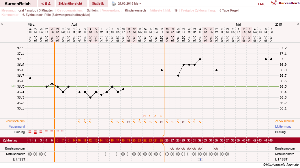 NFP-Kurve User #27540