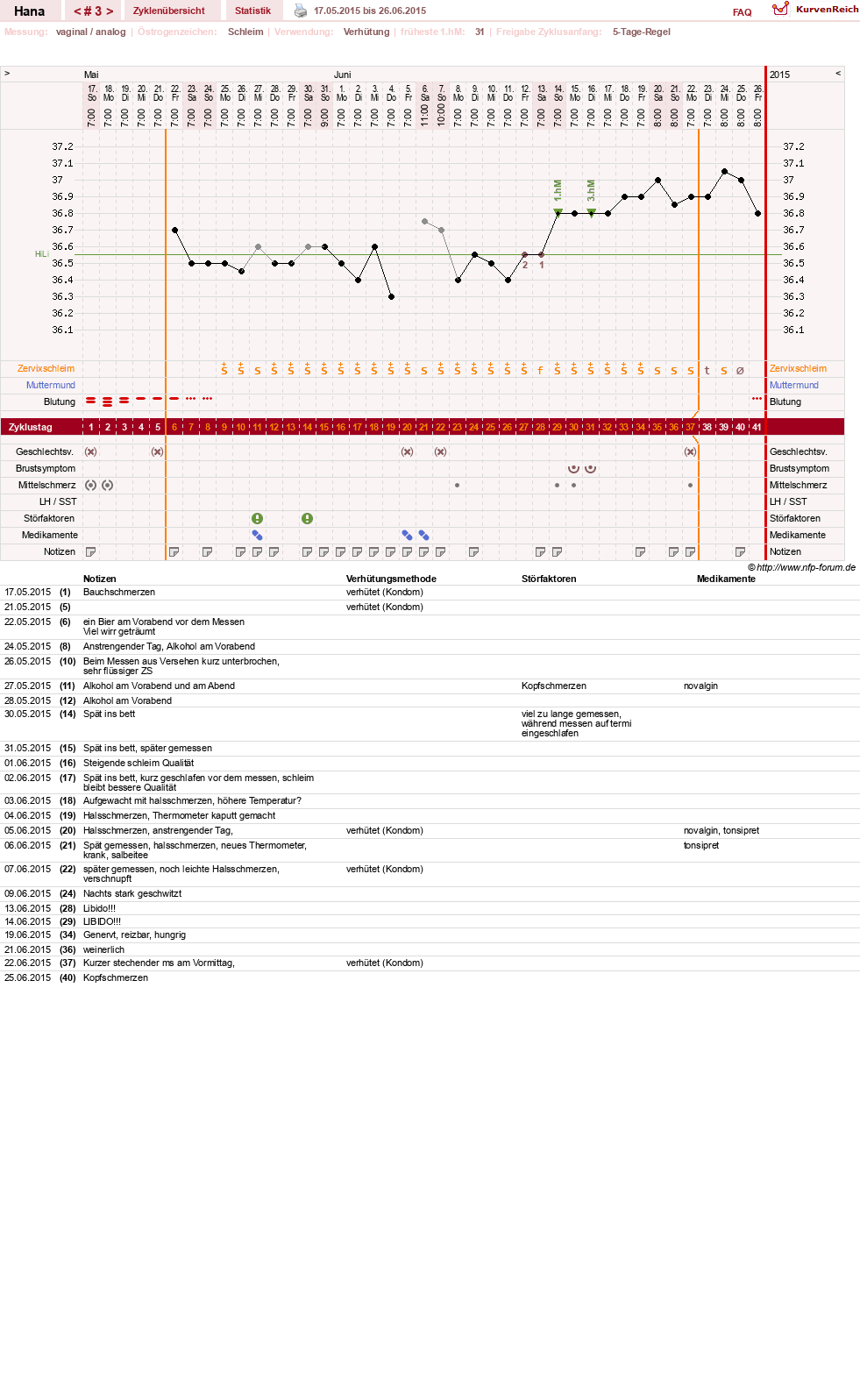 NFP-Kurve User #27587