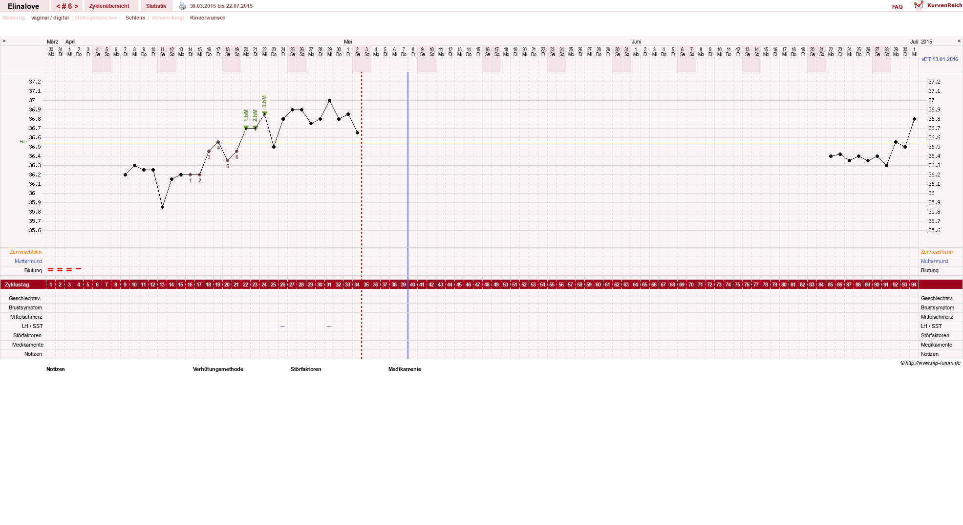 NFP-Kurve User #27748