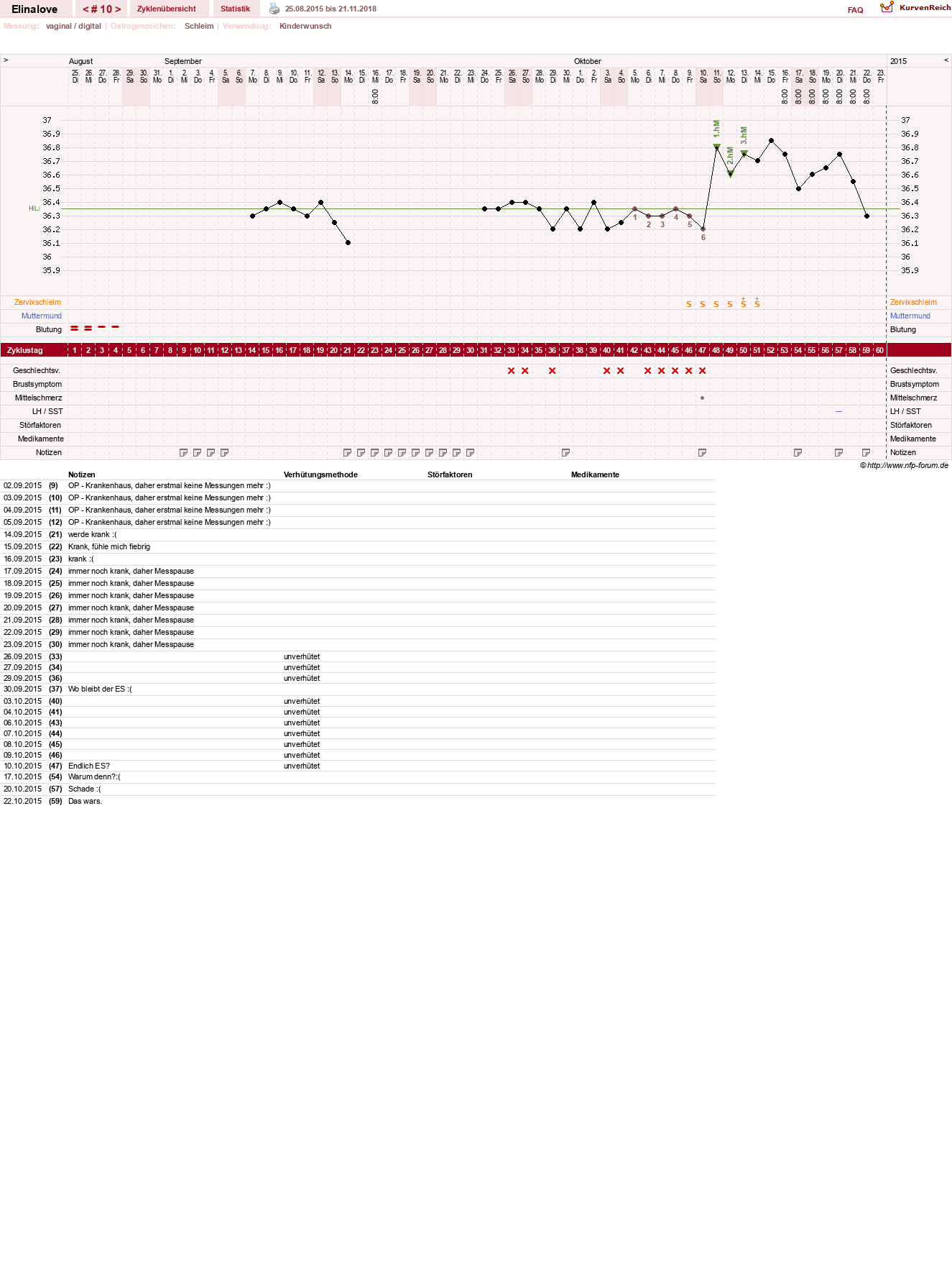 NFP-Kurve User #27748