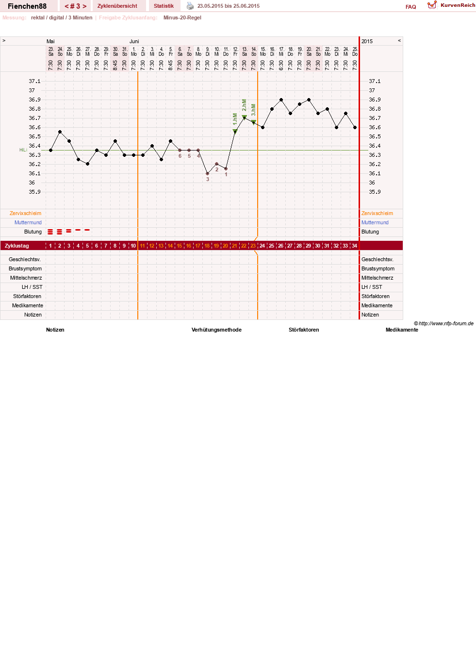NFP-Kurve User #27784