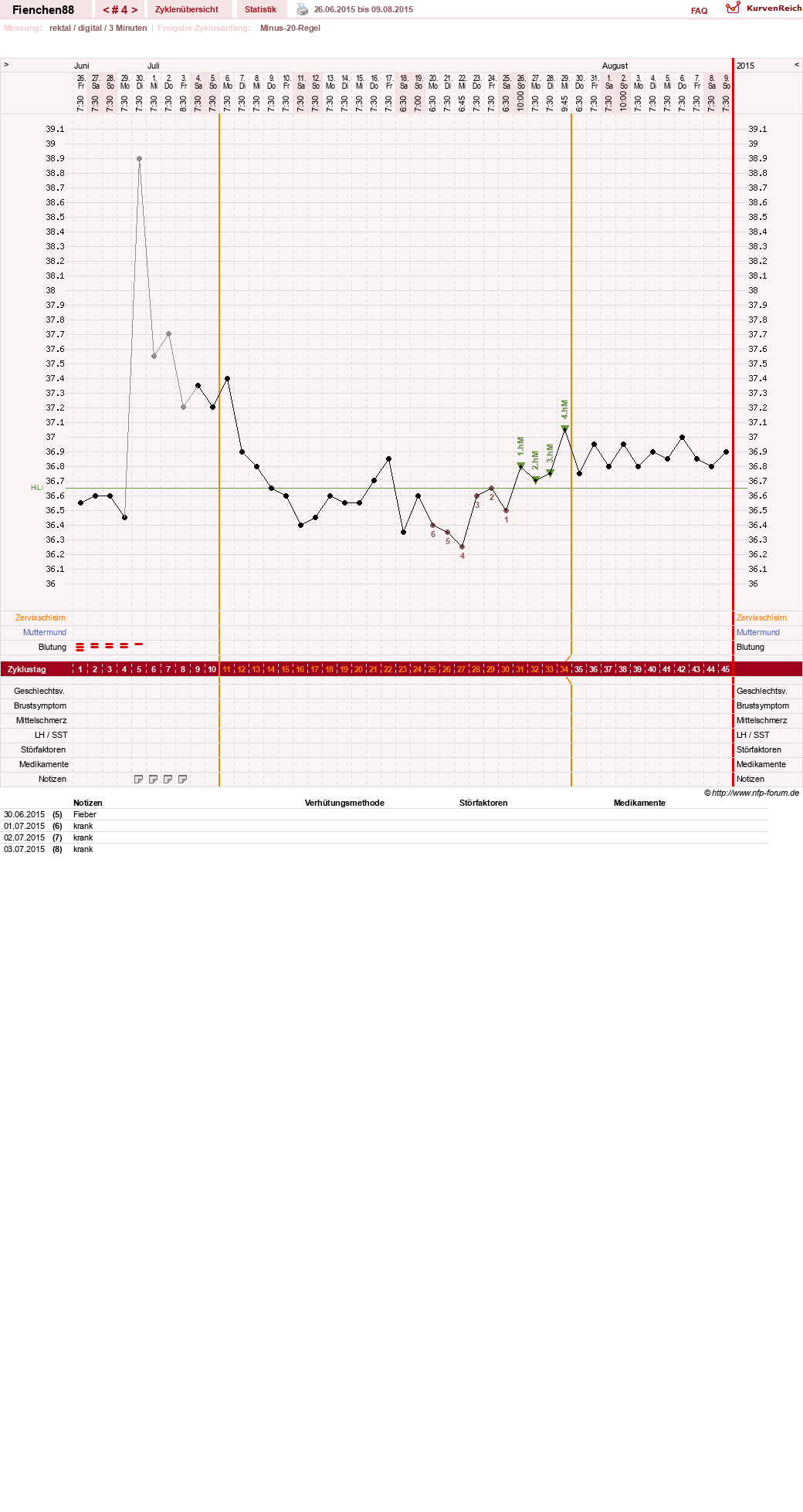 NFP-Kurve User #27784