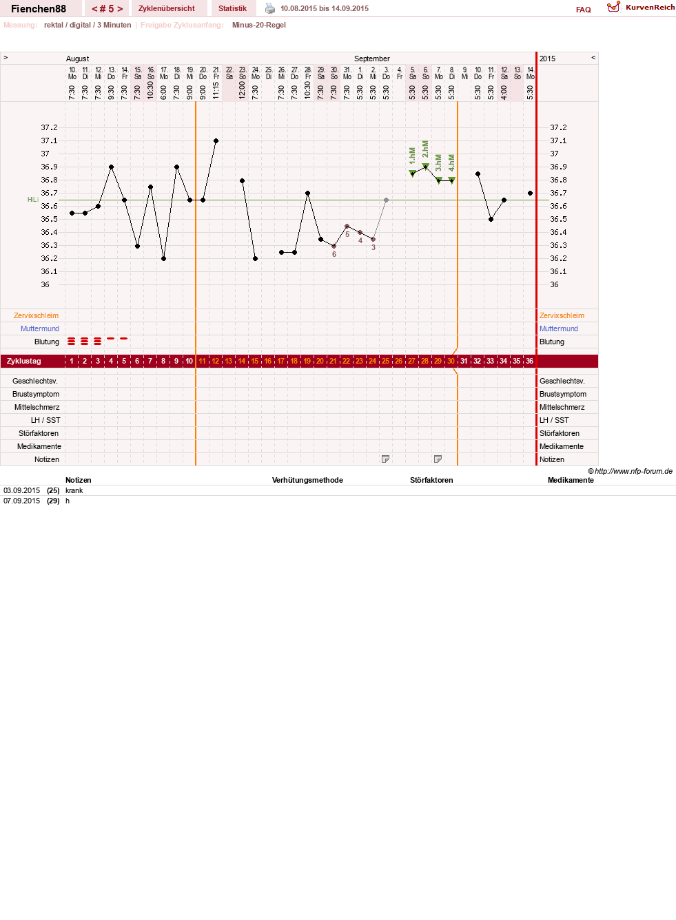 NFP-Kurve User #27784