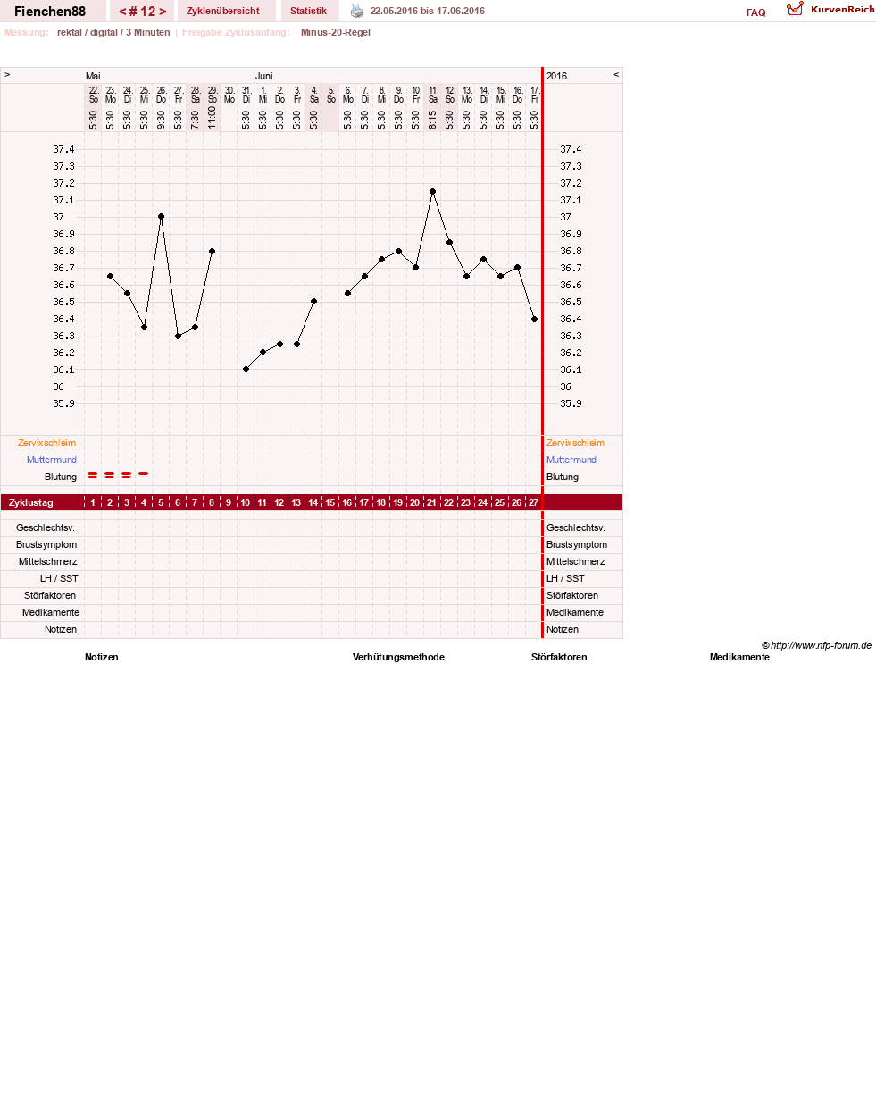 NFP-Kurve User #27784