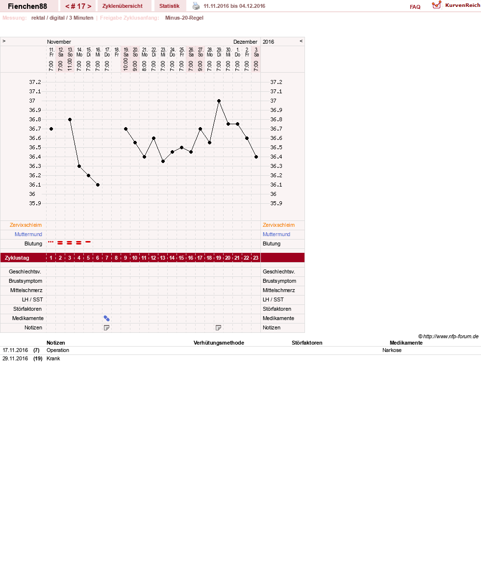 NFP-Kurve User #27784