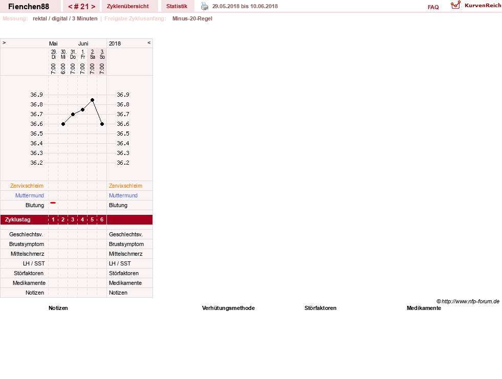 NFP-Kurve User #27784