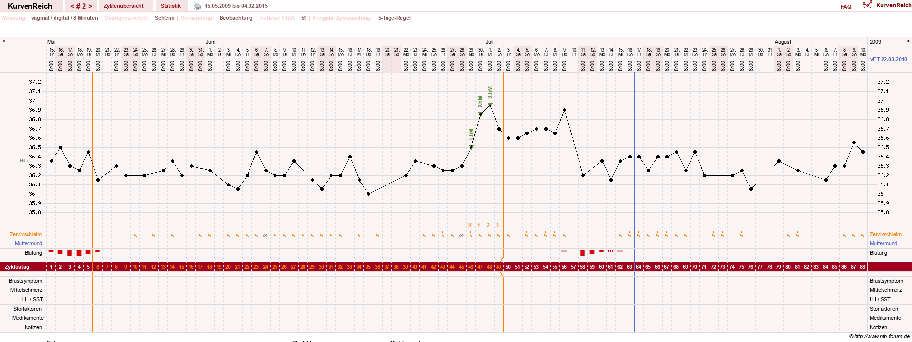 NFP-Kurve User #27856