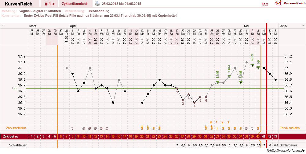 NFP-Kurve User #27863