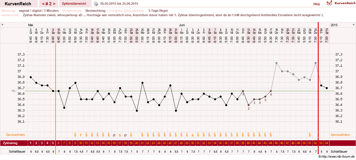 NFP-Kurve User #27863