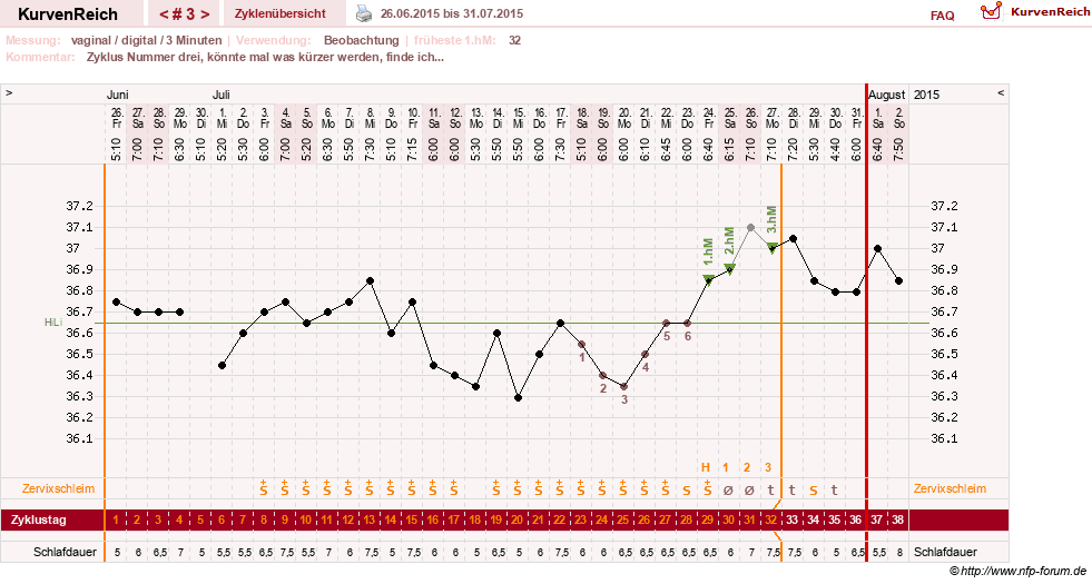 NFP-Kurve User #27863