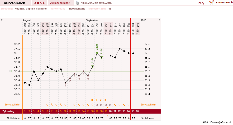 NFP-Kurve User #27863