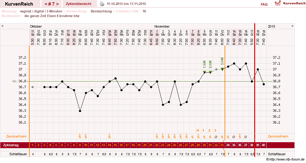 NFP-Kurve User #27863
