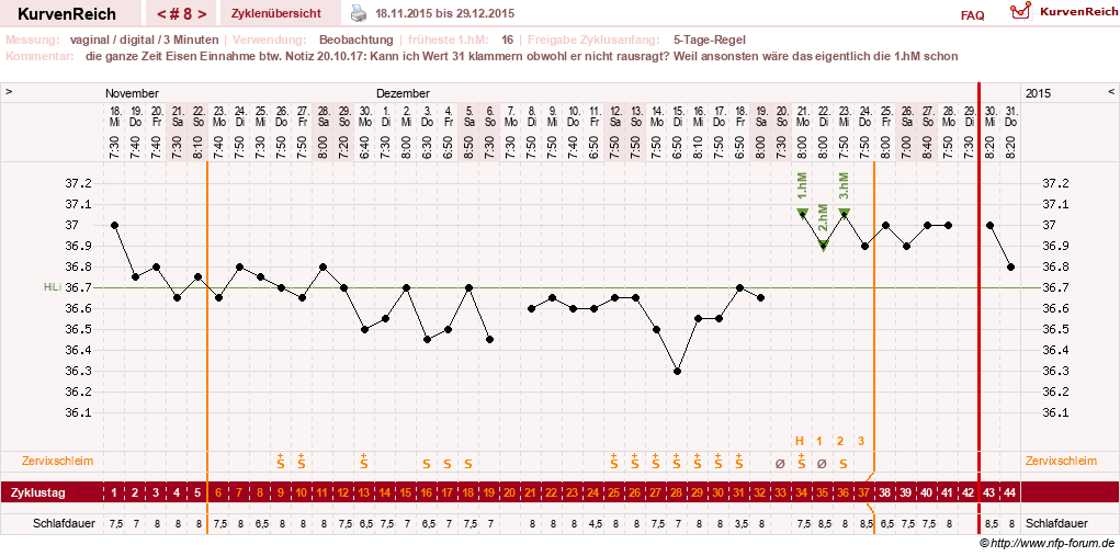 NFP-Kurve User #27863