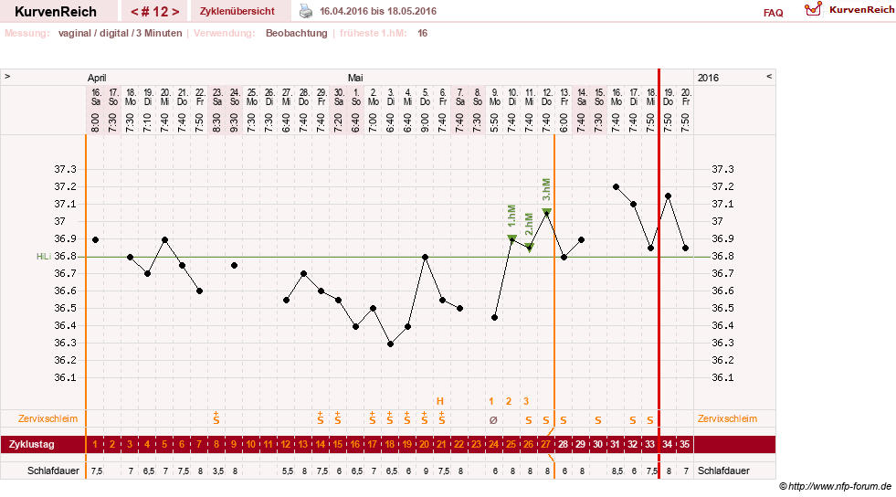 NFP-Kurve User #27863