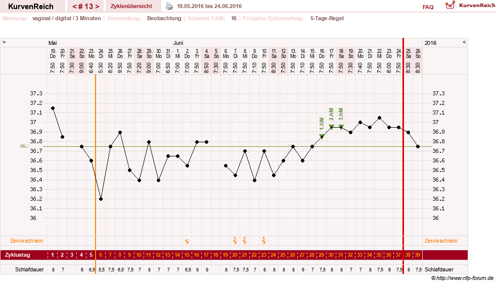 NFP-Kurve User #27863
