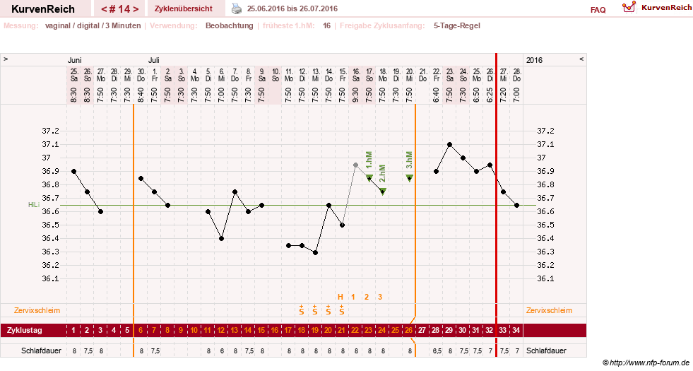 NFP-Kurve User #27863