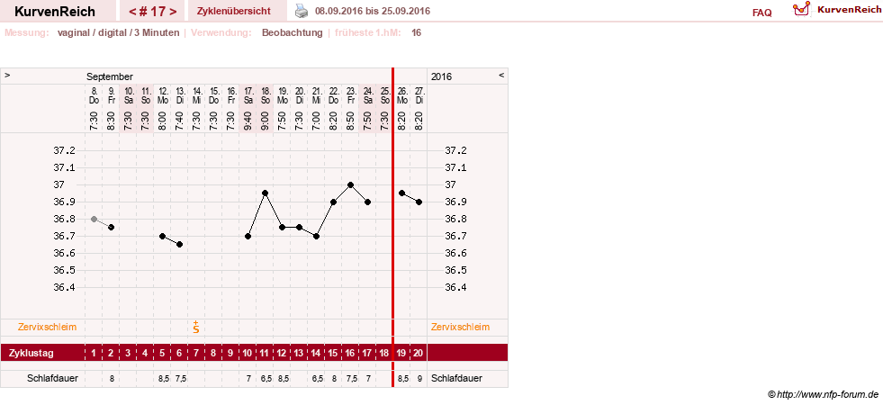 NFP-Kurve User #27863