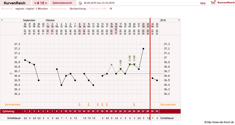 NFP-Kurve User #27863
