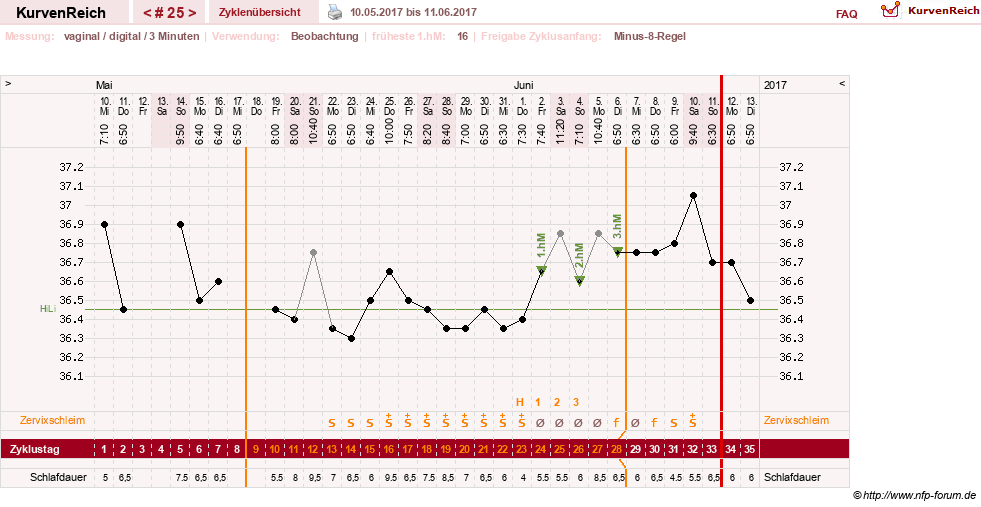 NFP-Kurve User #27863