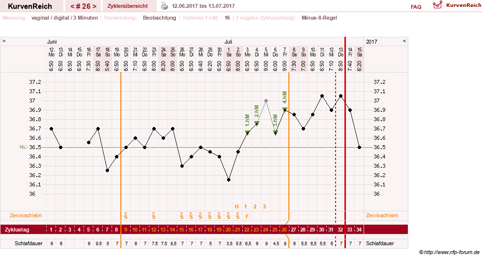NFP-Kurve User #27863