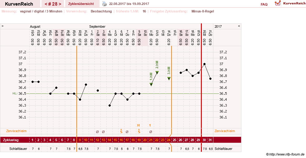 NFP-Kurve User #27863