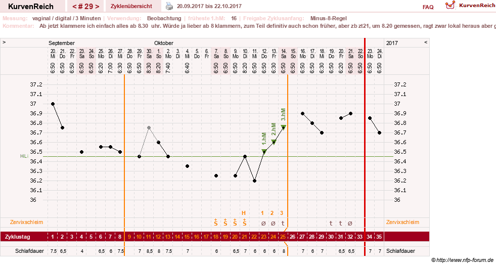 NFP-Kurve User #27863