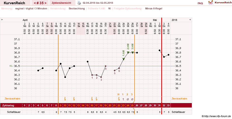 NFP-Kurve User #27863