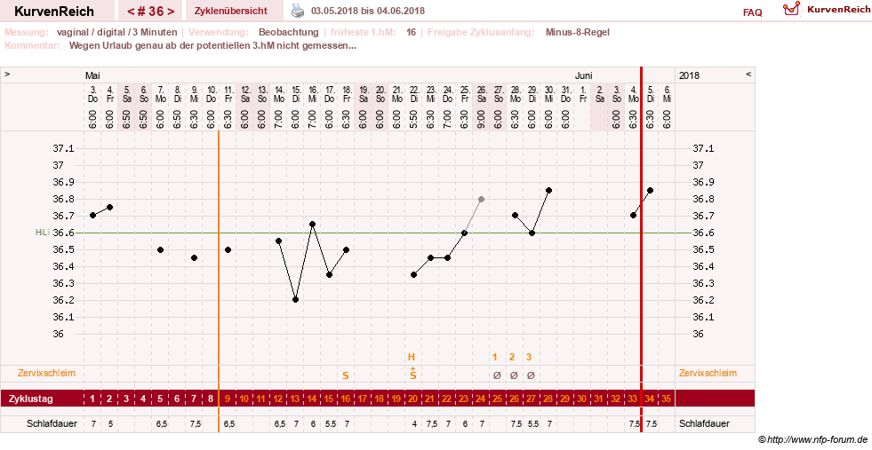 NFP-Kurve User #27863
