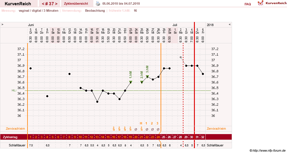 NFP-Kurve User #27863